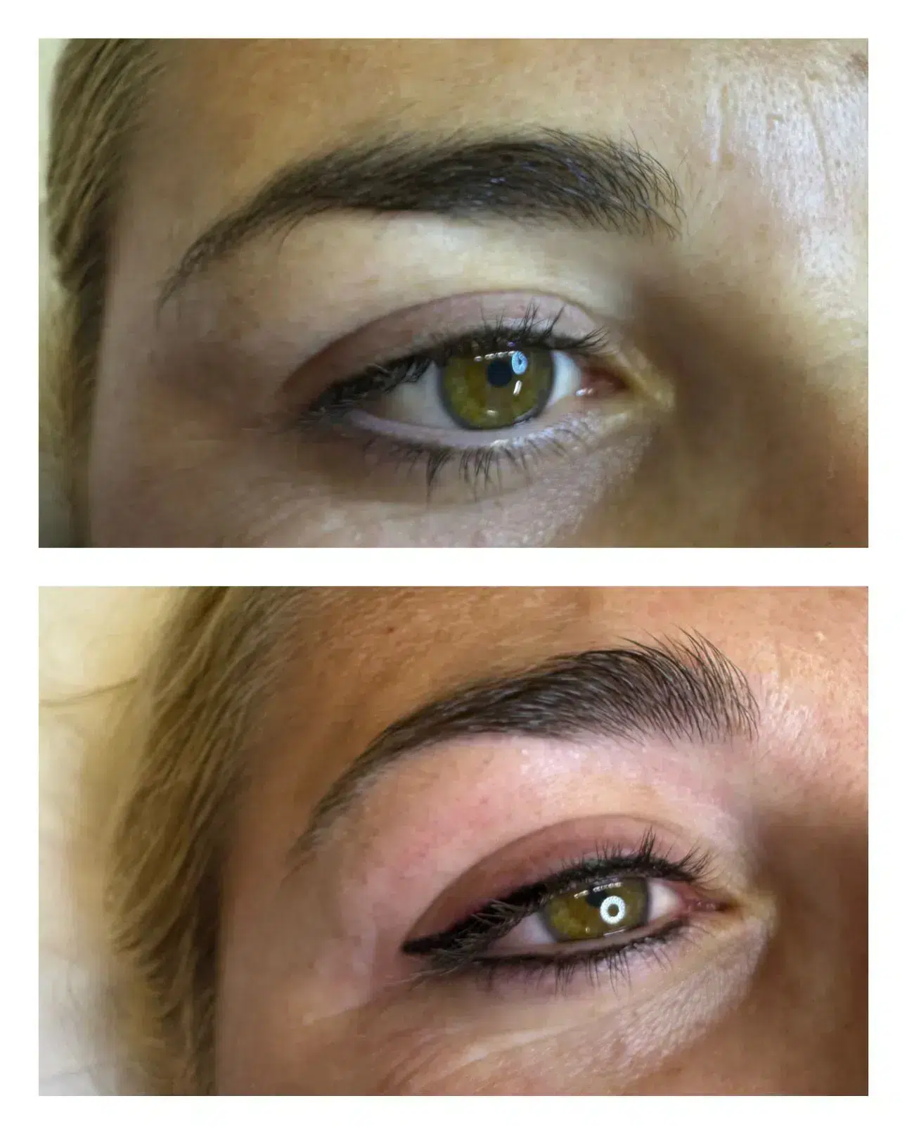 Tratamiento de belleza facial - Esencia Estética